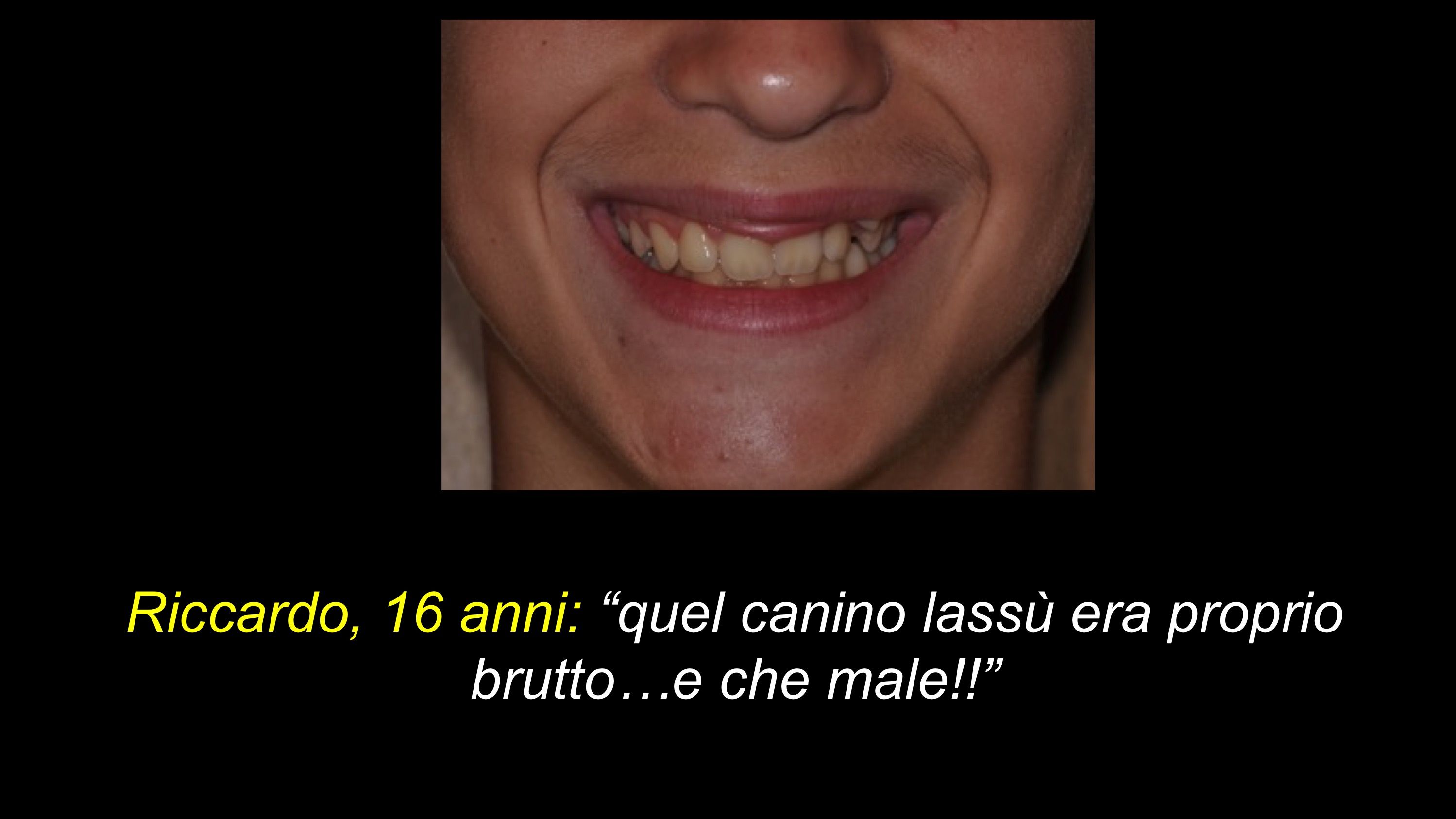 prima