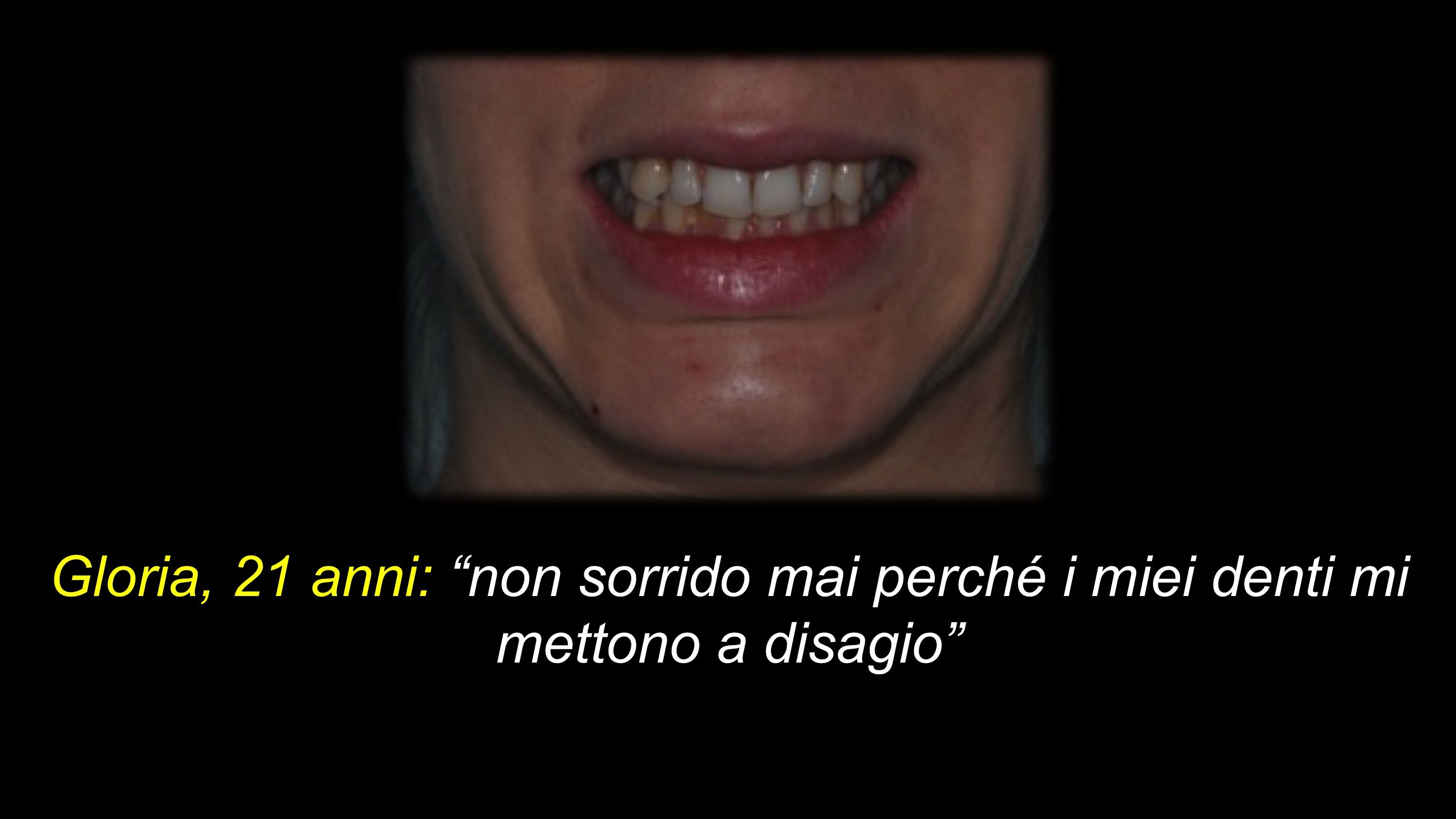 prima