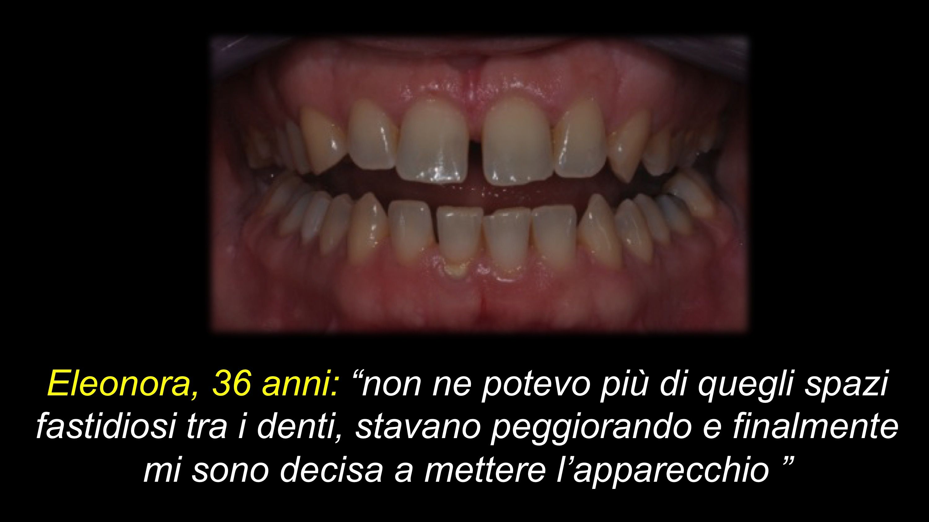 prima