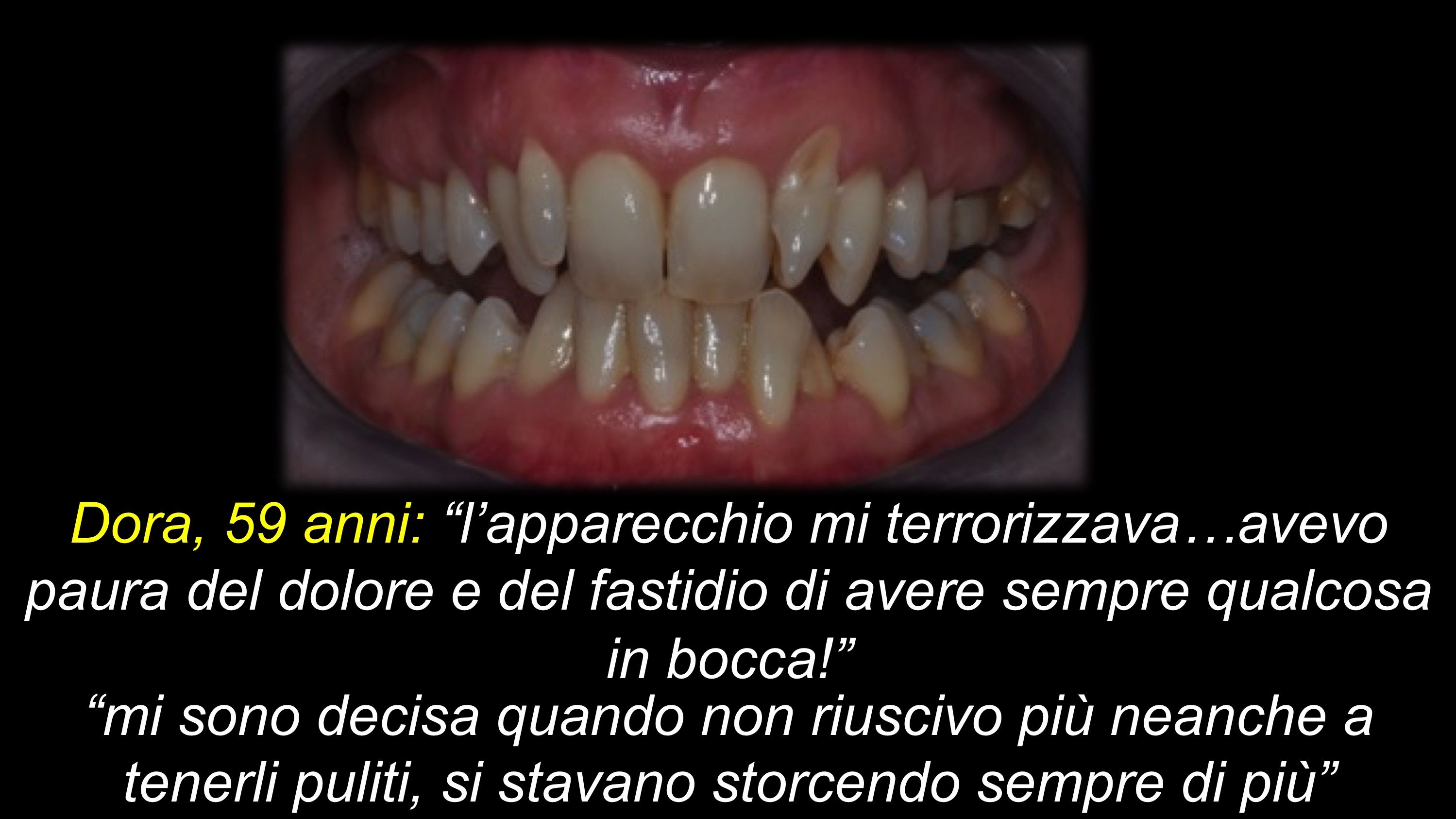 prima