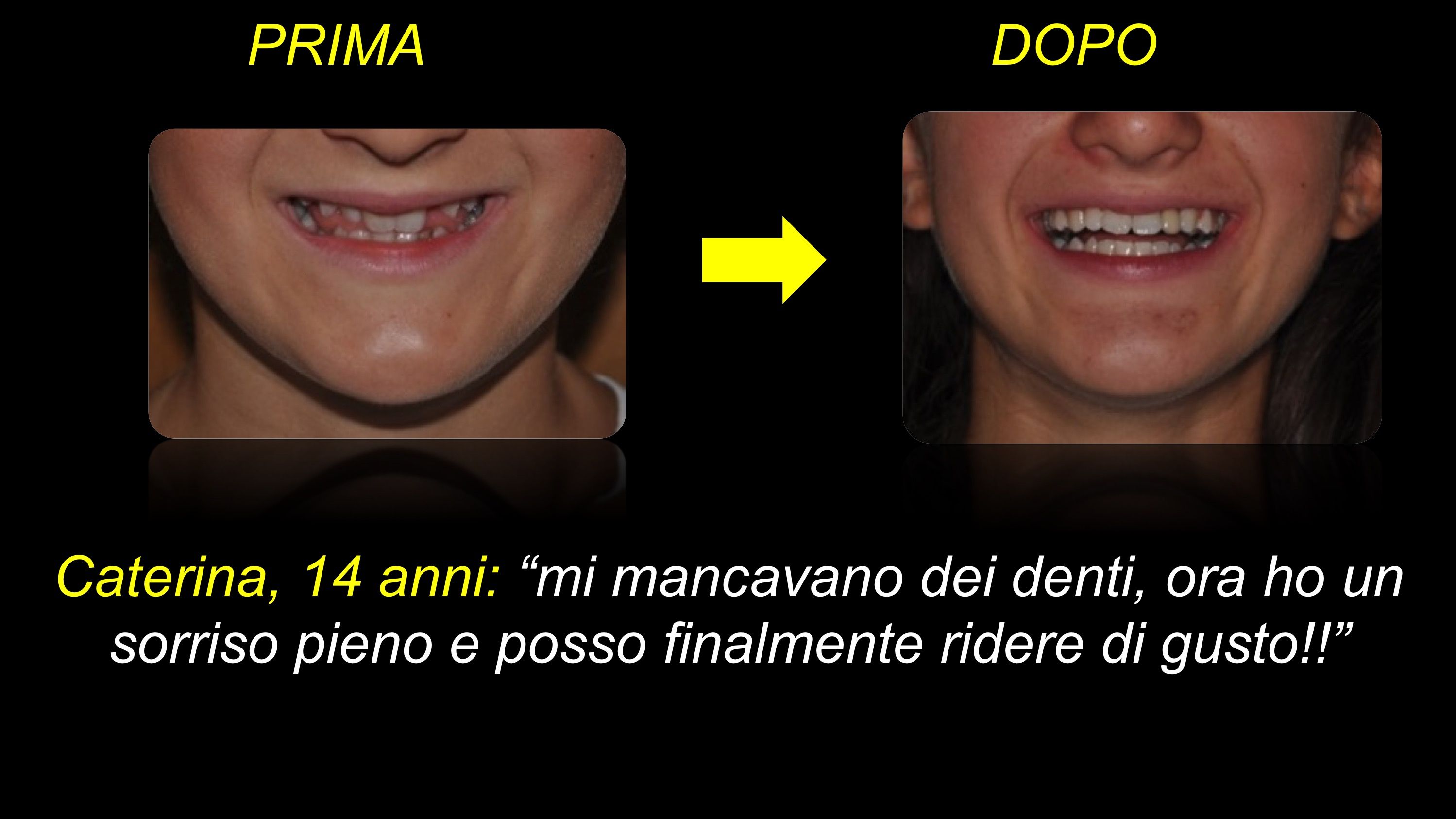 prima